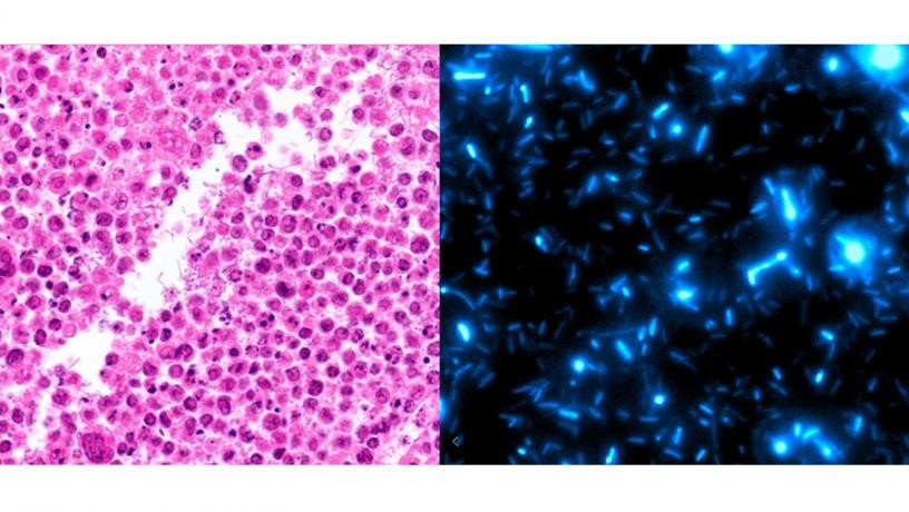 Histology image of bacteria growing within necrotic regions of lymphoma tumors (LEFT). Bacteria are programmed to undergo waves of growth and self-destruction leading to immunotherapeutic release (RIGHT).